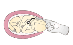 rotate anterior shoulder anteriorly image