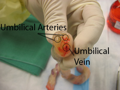 Umbilical vessel photo