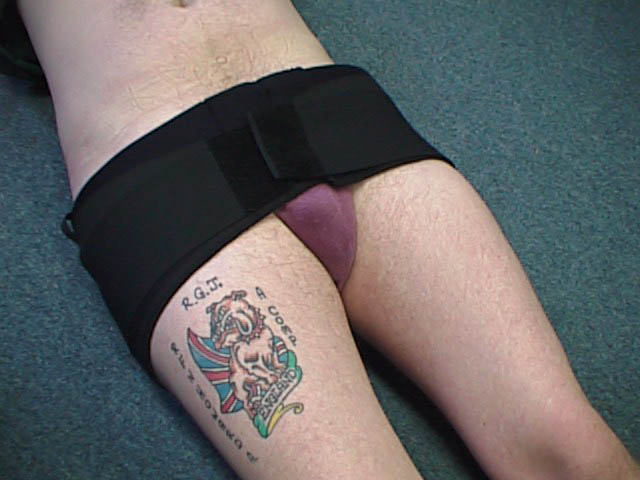 pelvic binder pelvic binder image
